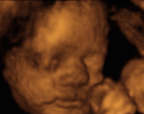 Pregnancy Week image