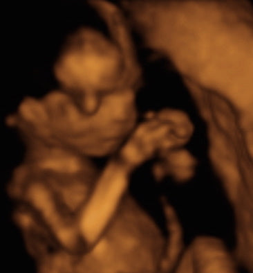 Pregnancy Week image