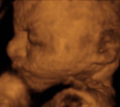 Pregnancy Week image