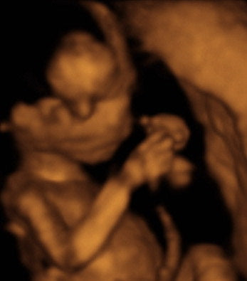 Pregnancy Week image