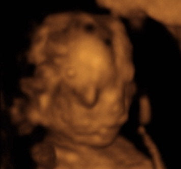 Pregnancy Week image