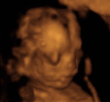 Pregnancy Week image