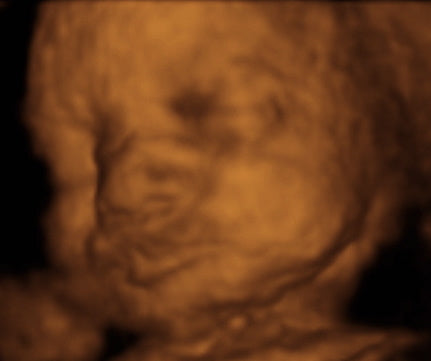 Pregnancy Week image