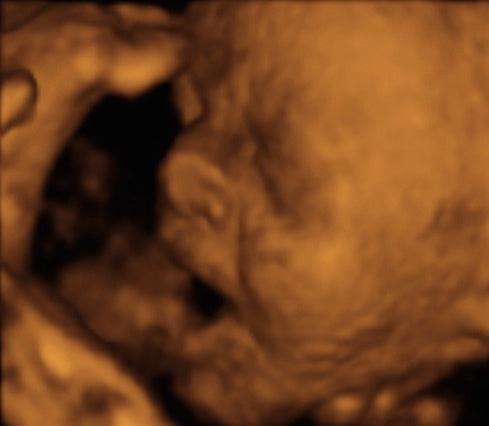 Pregnancy Week image