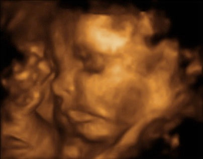 Pregnancy Week image