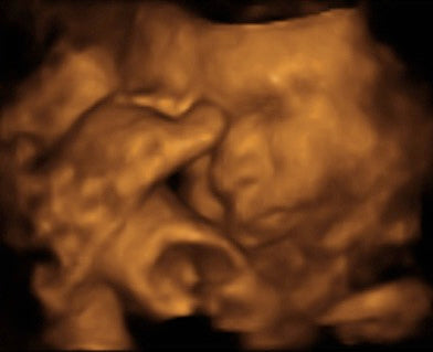 Pregnancy Week image