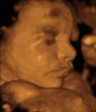 Pregnancy Week image