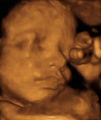 Pregnancy Week image