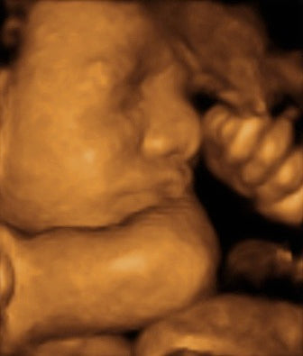 Pregnancy Week image