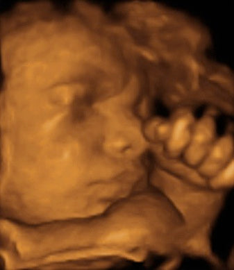 Pregnancy Week image