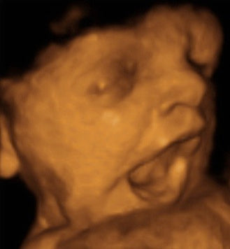 Pregnancy Week image