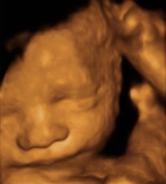 Pregnancy Week image