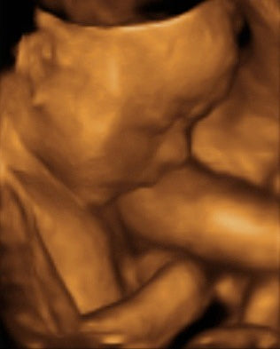Pregnancy Week image