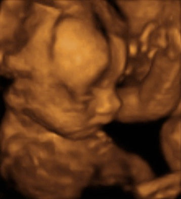 Pregnancy Week image