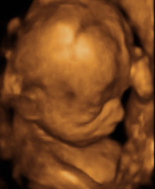 Pregnancy Week image