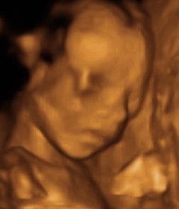 Pregnancy Week image