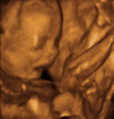 Pregnancy Week image