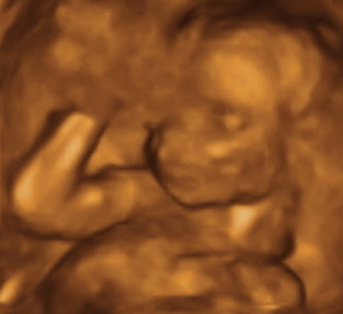 Pregnancy Week image