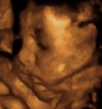 Pregnancy Week image