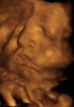 Pregnancy Week image