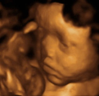 Pregnancy Week image