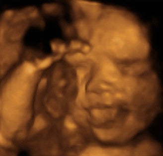 Pregnancy Week image