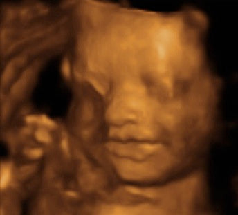 Pregnancy Week image