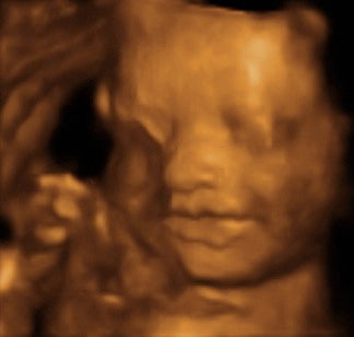 Pregnancy Week image