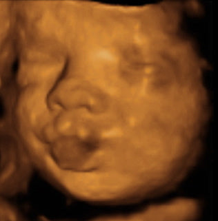 Pregnancy Week image