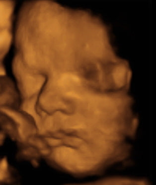 Pregnancy Week image