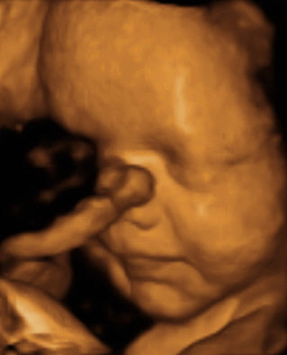 Pregnancy Week image