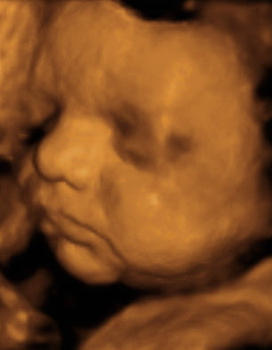 Pregnancy Week image