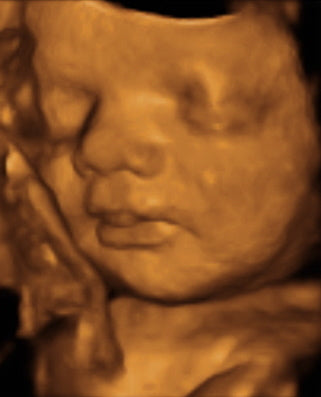 Pregnancy Week image
