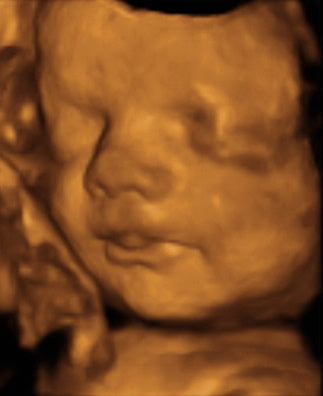 Pregnancy Week image