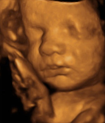 Pregnancy Week image