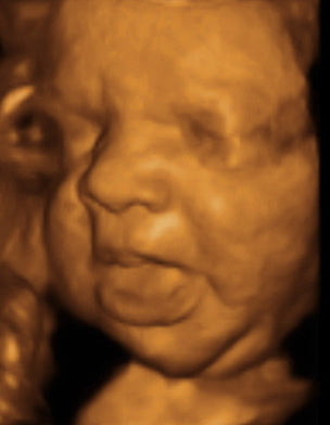 Pregnancy Week image