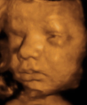 Pregnancy Week image