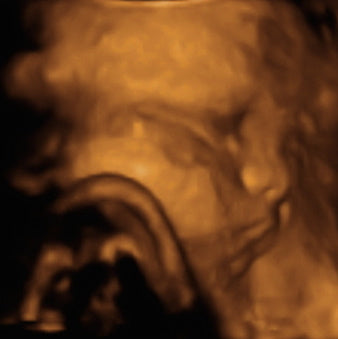 Pregnancy Week image