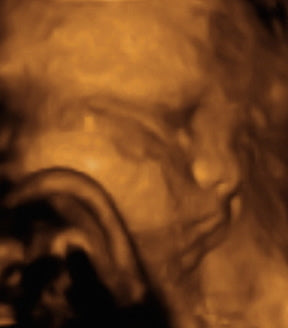 Pregnancy Week image