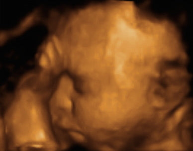 Pregnancy Week image