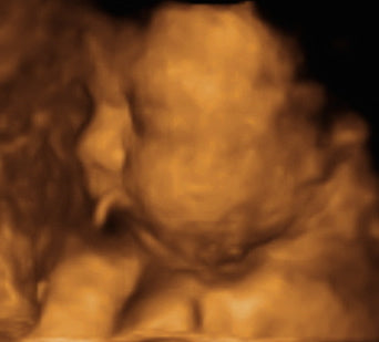 Pregnancy Week image