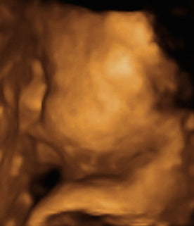 Pregnancy Week image
