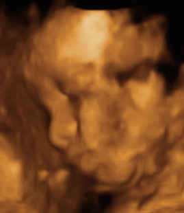 Pregnancy Week image