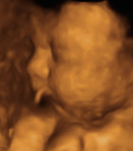 Pregnancy Week image