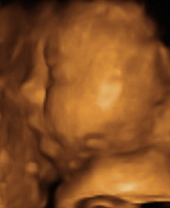 Pregnancy Week image