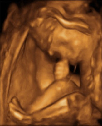 Pregnancy Week image