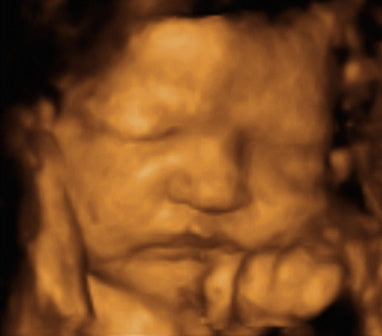 Pregnancy Week image