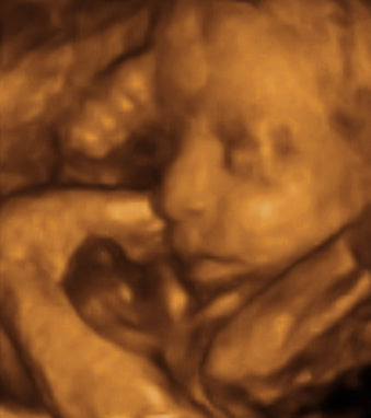 Pregnancy Week image