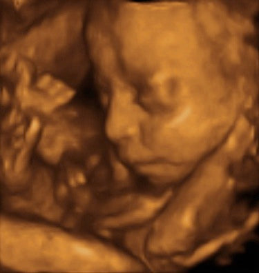 Pregnancy Week image