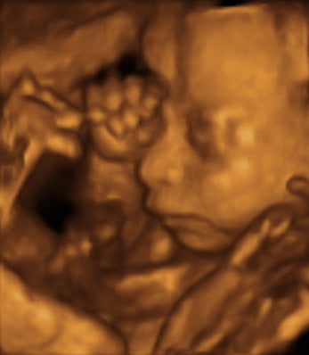 Pregnancy Week image